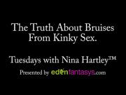 Tuesdays with Nina - The Truth About Bruises From Kinky Sex.
