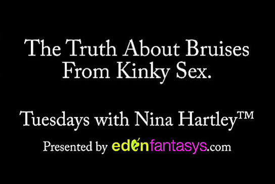 Tuesdays with Nina - The Truth About Bruises From Kinky Sex.